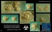 mycobacterium tuberculosis